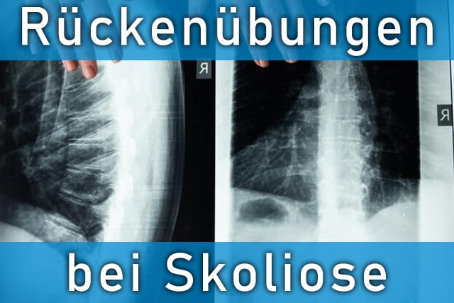 Skoliose Übungen im Fitnessstudion