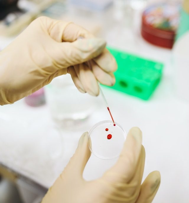 Aminogram based on blood test